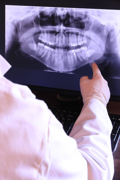 Best Emergency Dental Care for Broken or Chipped Teeth in Cornelia, GA